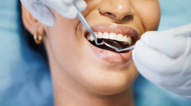 Best Emergency Broken Tooth Repair in Payne, OH