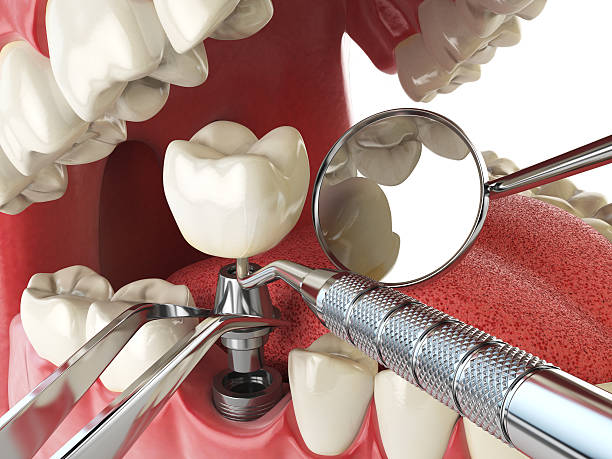 Best Emergency Treatment for Toothache in Payne, OH